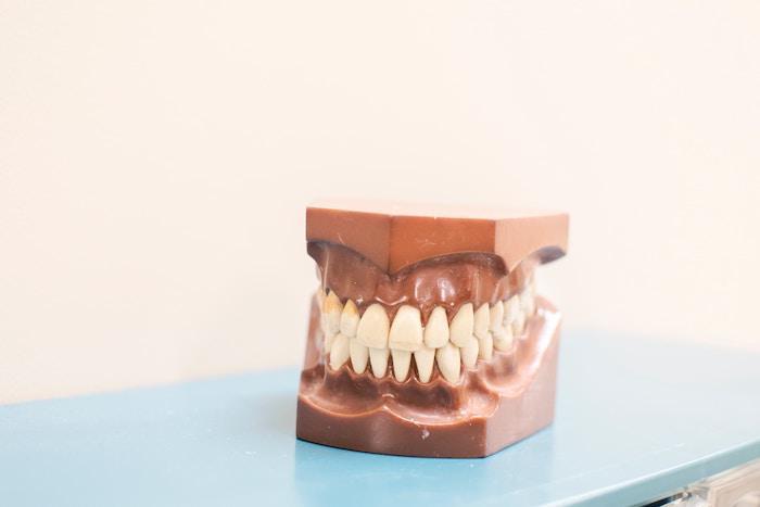 4 Common Causes of Discolored Teeth