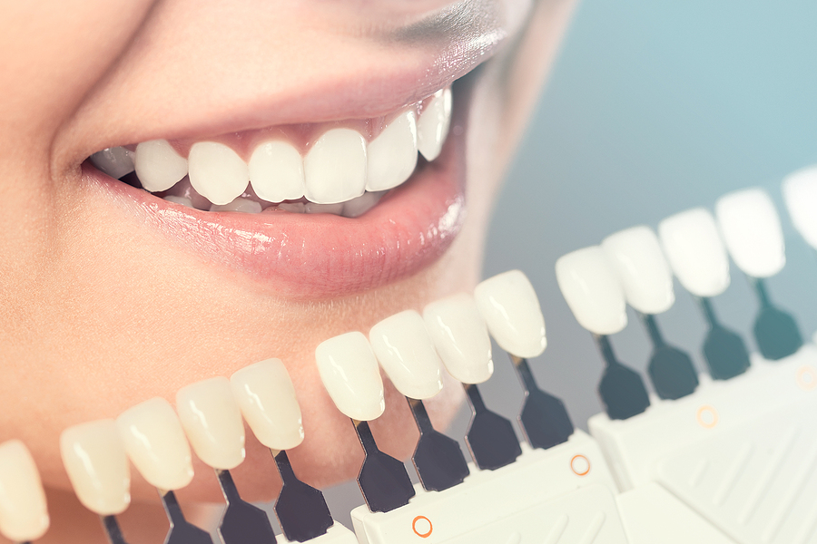 Transform Your Smile with Cosmetic Dentistry in Tomball, TX