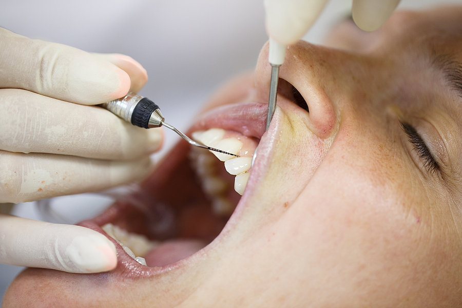 Comprehensive Guide to Periodontal Care in Tomball, TX: Ensuring Healthy Gums for a Bright Smile