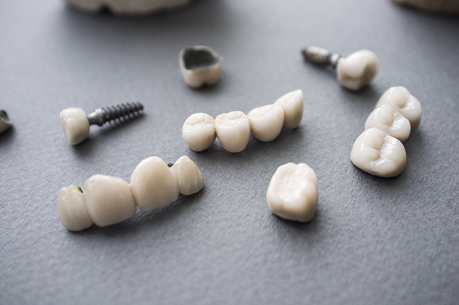 Same-Day Crowns – CEREC: A Fast and Efficient Solution for Restoring Your Smile in Tomball, TX